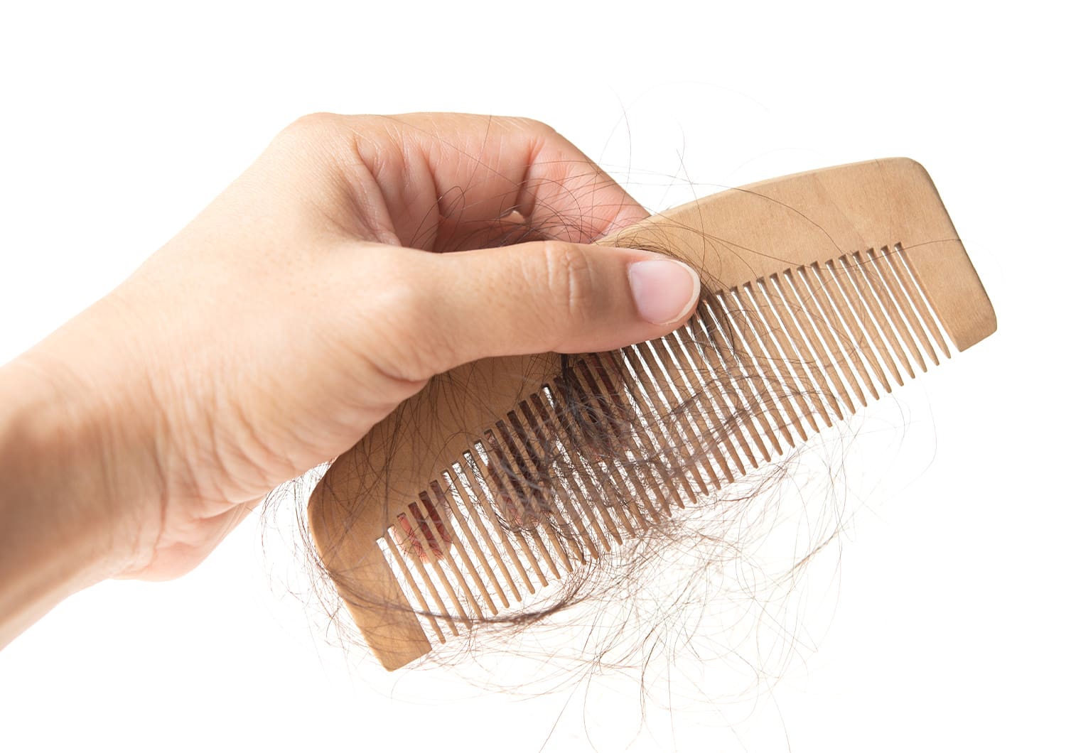 HAIR LOSS_shutterstock_1334978615